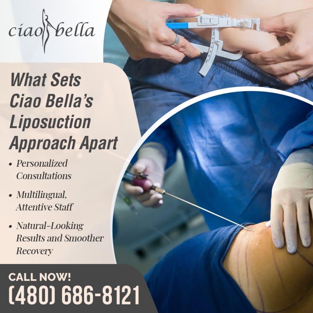liposuction surgery in Chandler, AZ