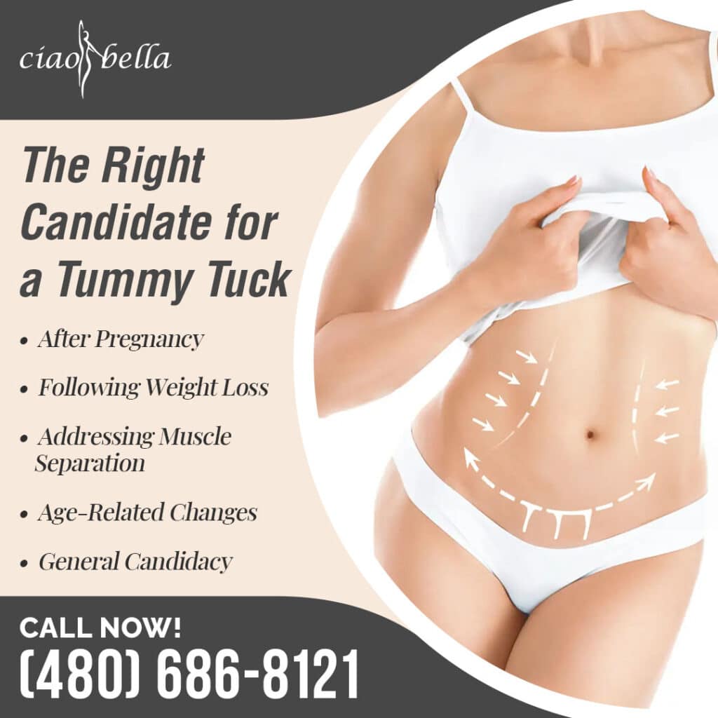 tummy tuck in Chandler
