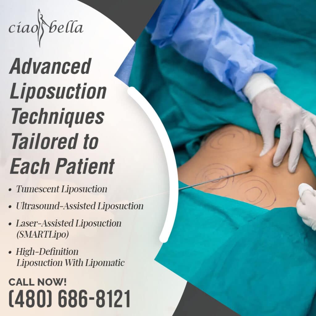 facelift surgery in Chandler