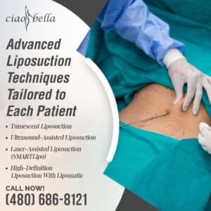 facelift surgery in Chandler