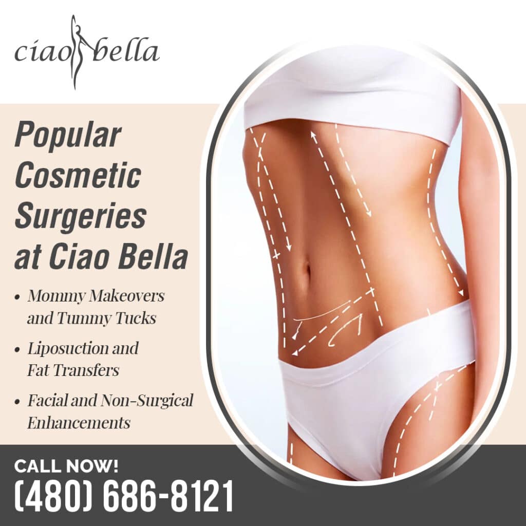 tummy tuck for muscle repair