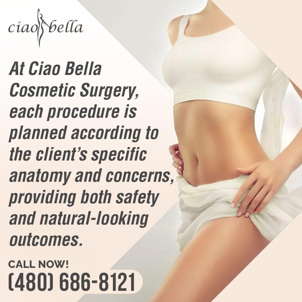 facelift surgery