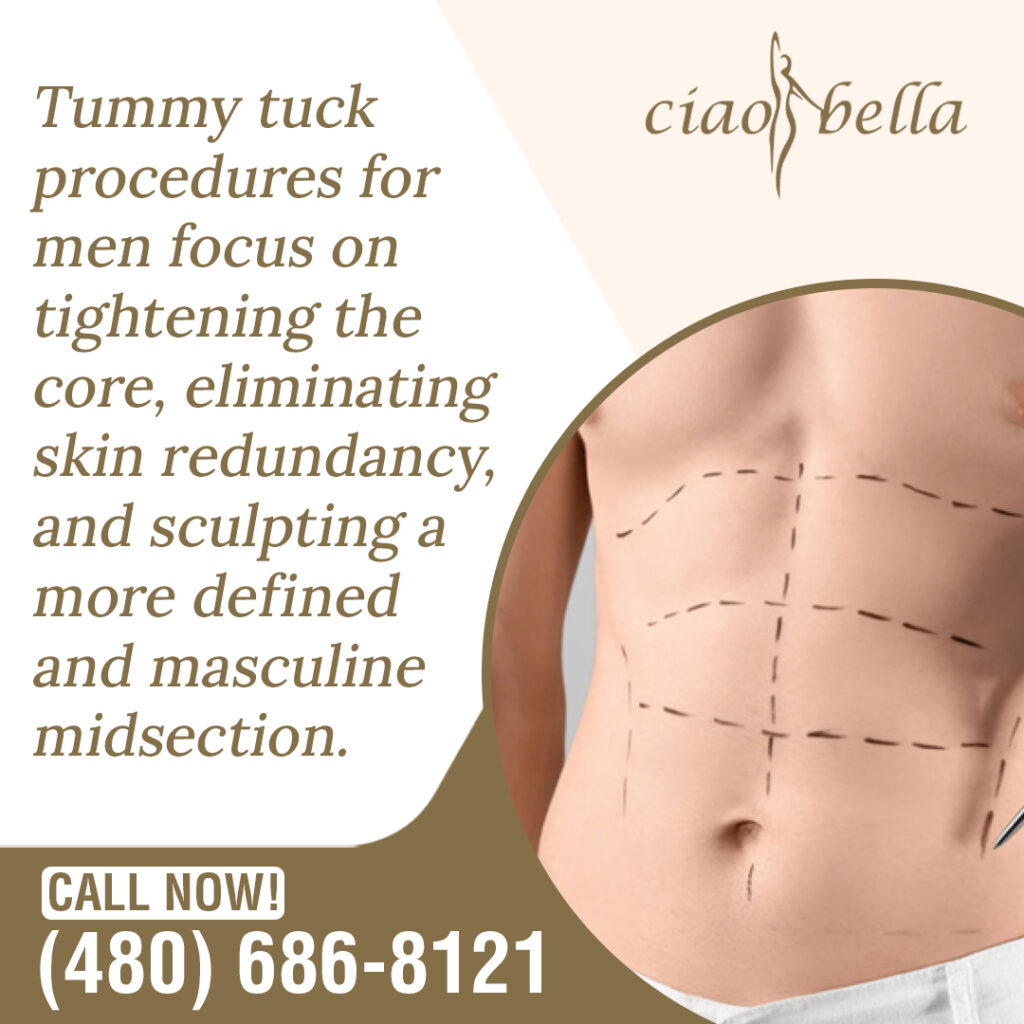tummy tuck procedure