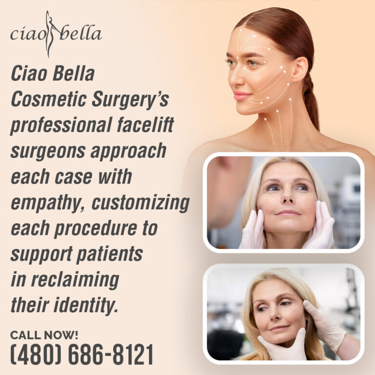 facelift surgeons in Chandler