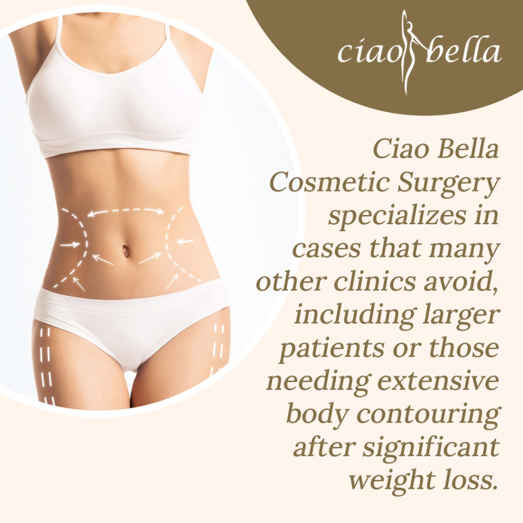 tummy tuck procedure