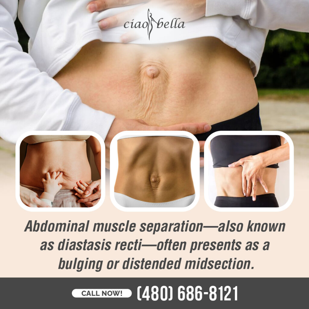 professional tummy tuck services in Chandler, AZ