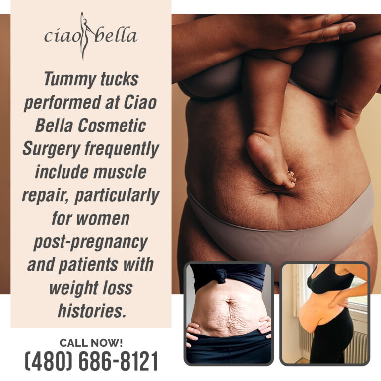 facelift procedures