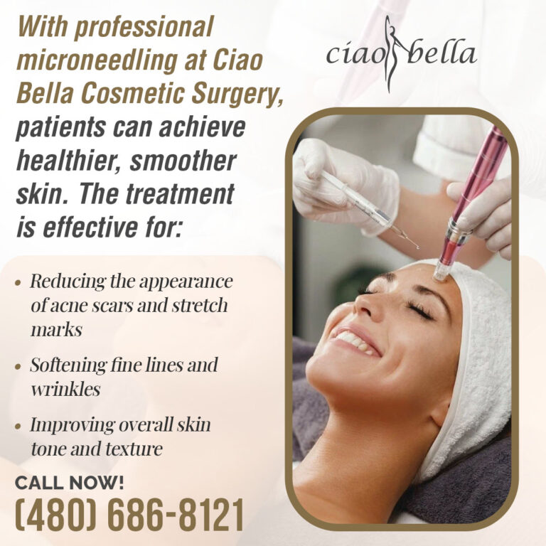 microneedling treatment