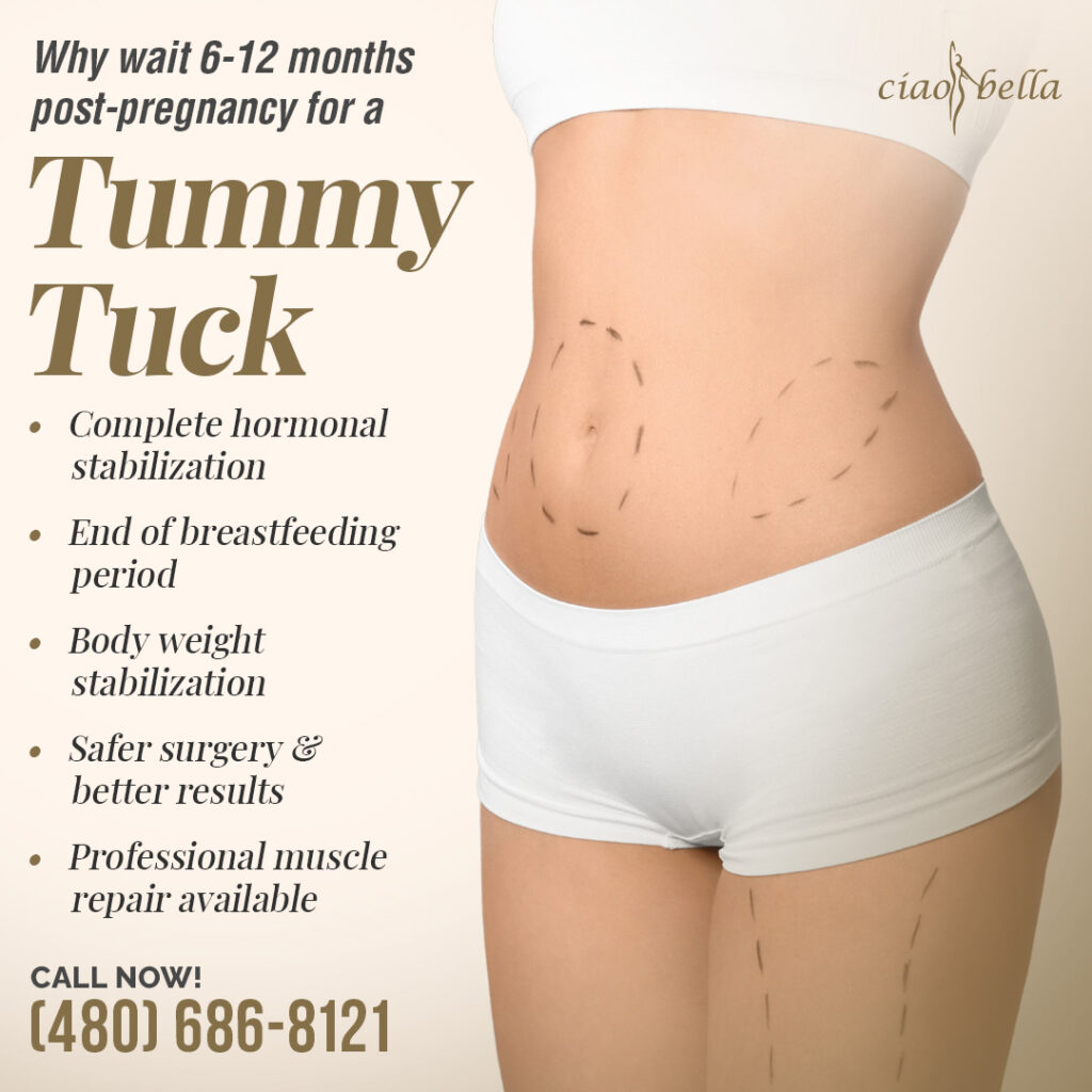tummy tuck after pregnancy