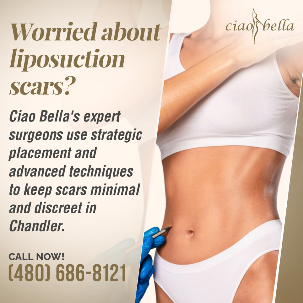 liposuction for love handles
