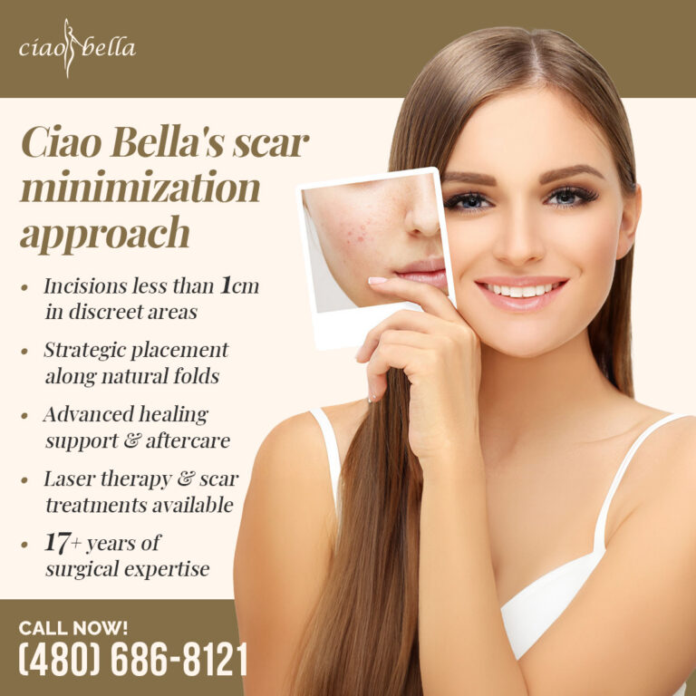 liposuction for love handles