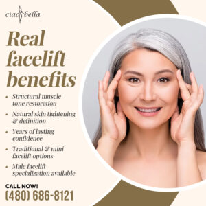 facelift surgery in Chandler, Arizona