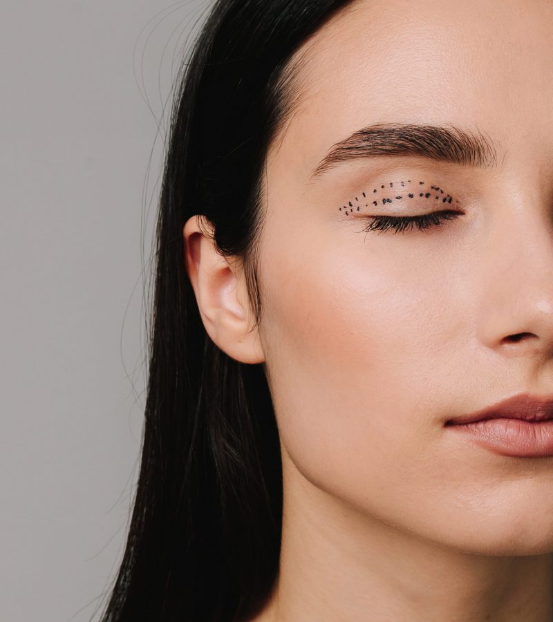 Preparing for blepharoplasty to do effective face lifting, remove excess skin and wrinkles from eyelids. Woman is showing well done contour for eye lids surgery